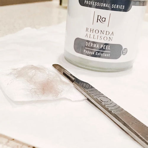 Dermaplaning treatment